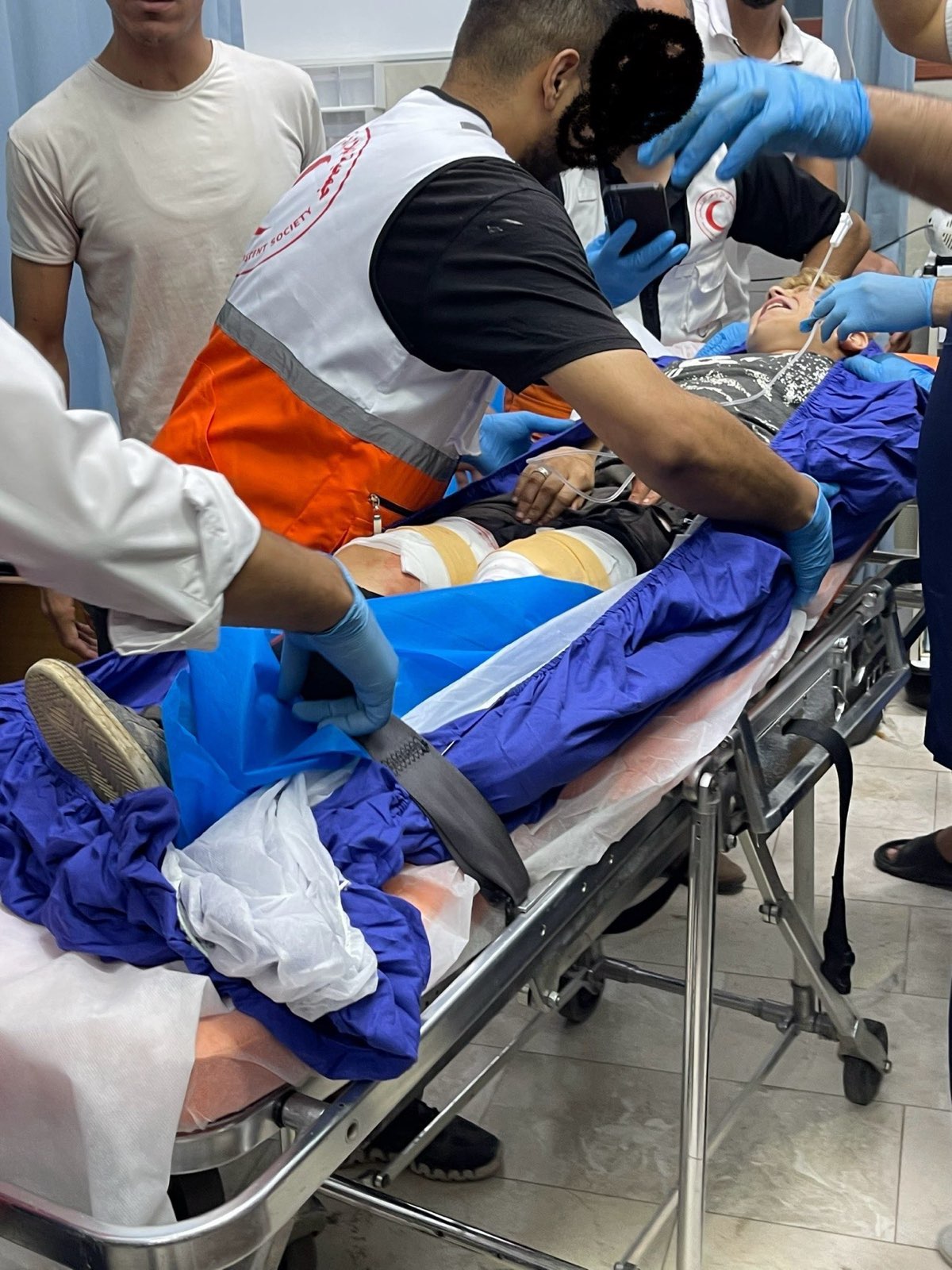 12 year-old boy at the hospital in nablus after being shot in both legs