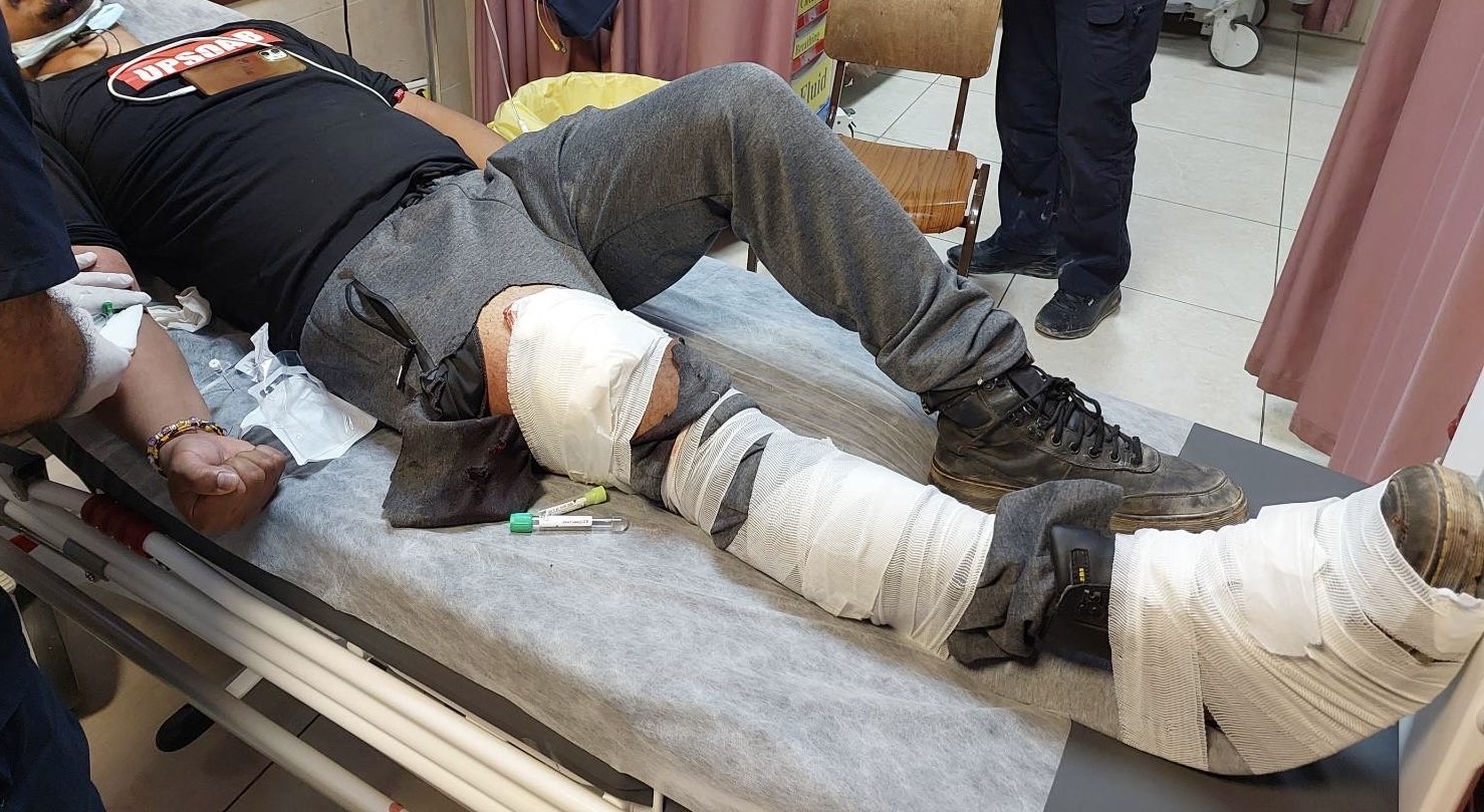 Amada Sison at the Rafidia hospital before being opperated