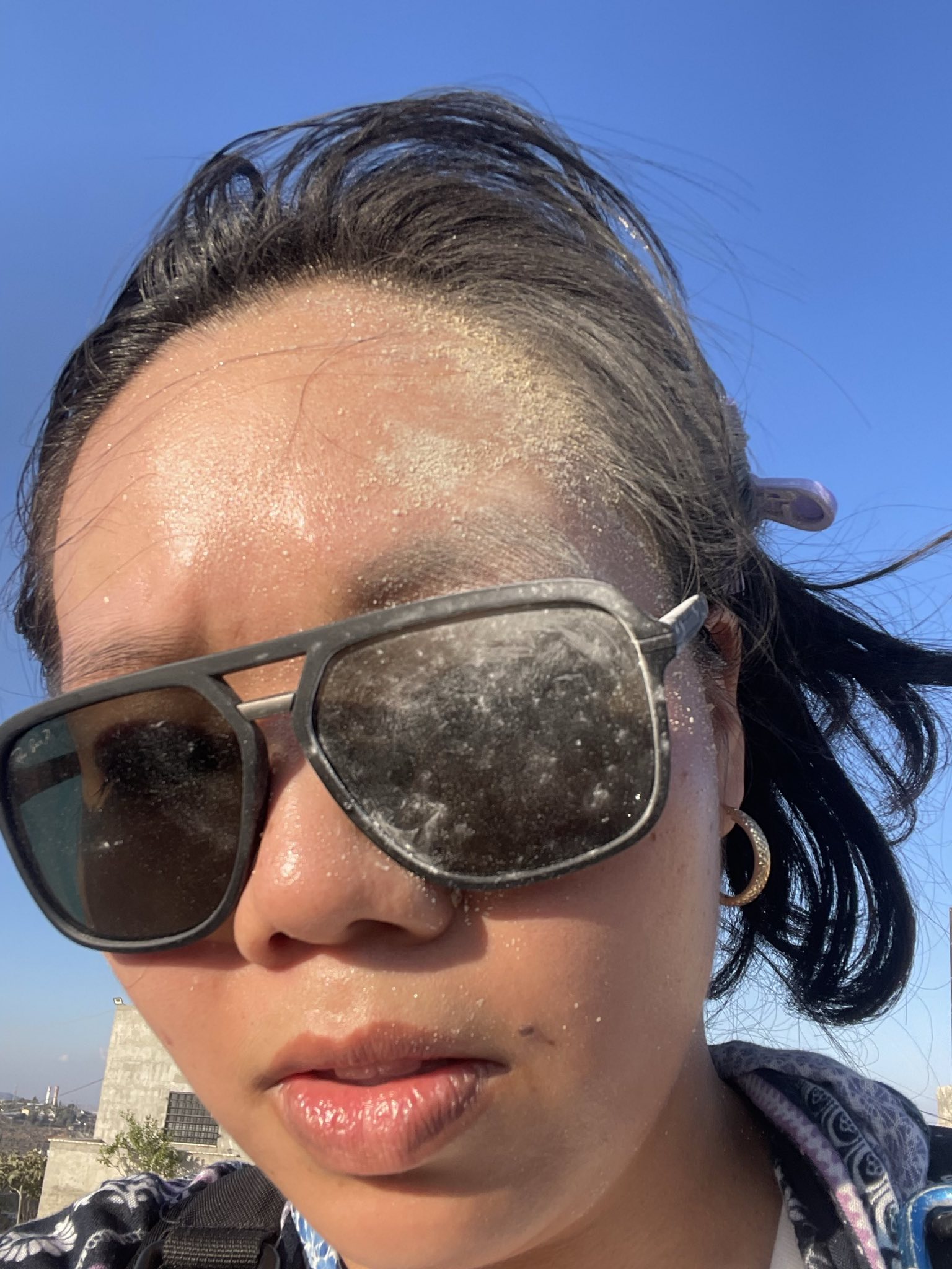 Vivi Chen after being hit in the face with a stone